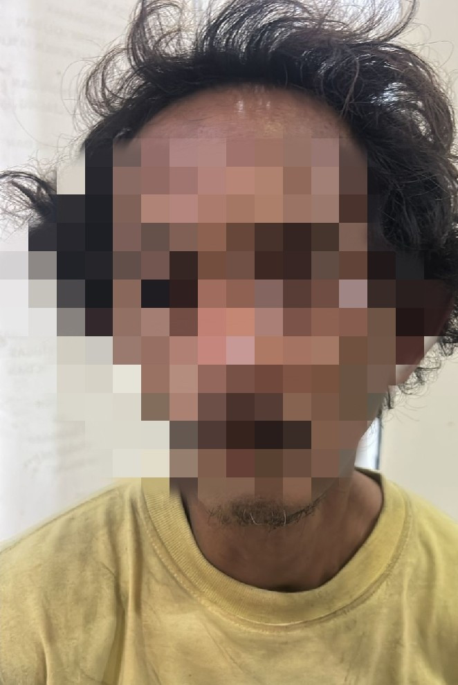 Ayah Kandung Diduga Setubuhi Anak di Pademangan, Korban Kini Hamil Enam Bulan